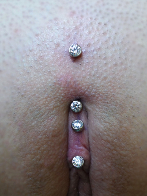 Vulva piercing shop